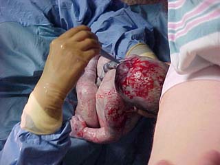 hospital17